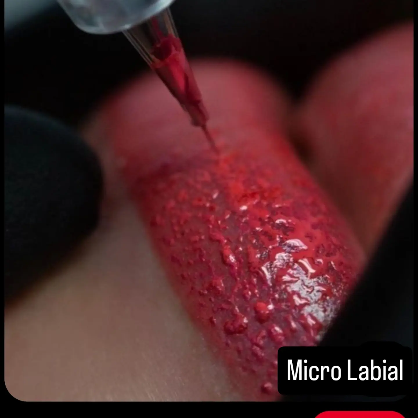 Momento do processo de micropigmentação labial